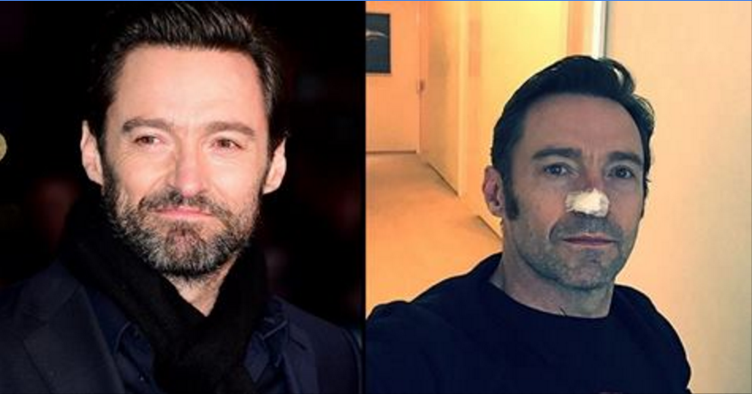 Il messaggio di Hugh Jackman ai fan è commovente: "Usatela, vi salverà la vita. Credetemi: io lo so"