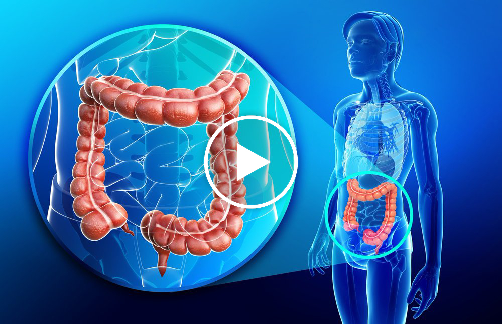 Ecco il rimedio per eliminare istantaneamente problemi di stitichezza e occlusione intestinale [VIDEO]