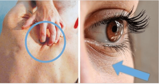 Senza rendertene conto stai assumendo troppi zuccheri. Ecco i segnali che il tuo corpo ti manda: