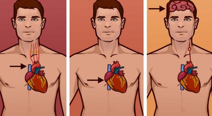 Impara la differenza fra un infarto, un arresto cardiaco e un ictus. Potresti salvare una vita: