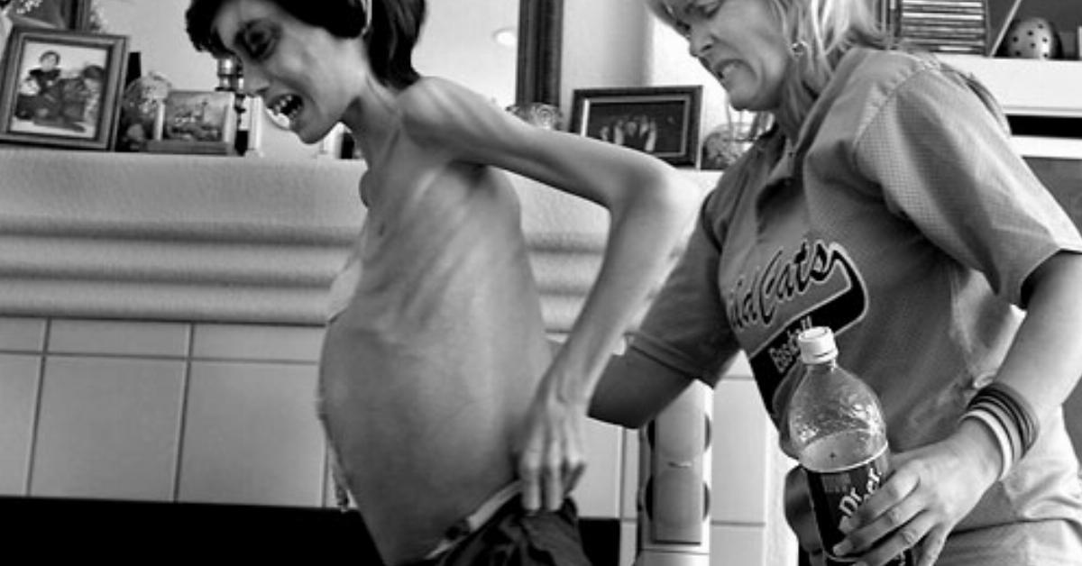 La madre ha preso per l'ultima volta tra le braccia il figlio emaciato. Poi è arrivato il momento di dire addio.