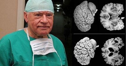 I neuroscienziati danno una notizia allarmante!