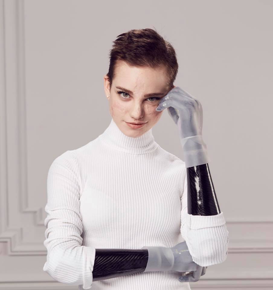 Beatrice Vio E' Una Delle Testimonial Di Loreal Makeup Per Il Fondotinta Accordparfait - Il Blog Di Marco Zuccardi