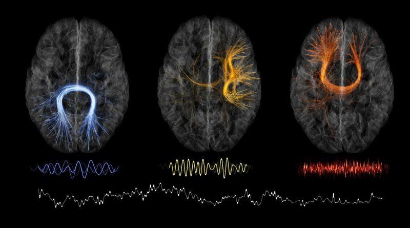 I neuroscienziati dicono che dimenticare è un segno di straordinaria intelligenza