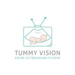 Tummy Vision