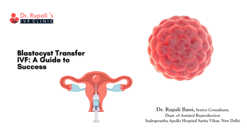 Blastocyst Transfer IVF: A Guide to Success: ext_6602037 — LiveJournal