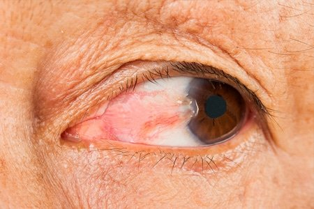 Key Checklist To Follow When Choosing The Best Laser Eye Surgeons - Pogeo.co.uk